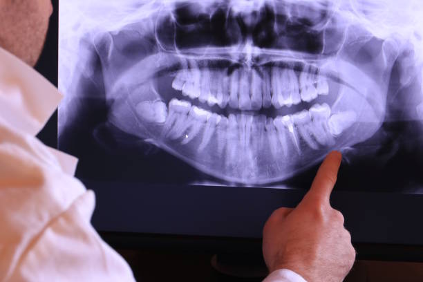 Best Emergency Dental Services for Seniors in Pine Bush, NY
